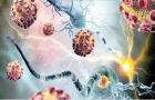 موفقیت محققان کشور در تولید مواد موثره داروهای ضد سرطان