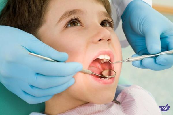 شیوع بالای پوسیدگی دندان در کودکان ایرانی/زنگ خطر برای دوران بزرگسالی