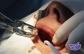الزام کالاهای دندانپزشکی به نصب برچسب اصالت/اعمال سیاست‌های جدید در قیمت‌گذاری تجهیزات پزشکی