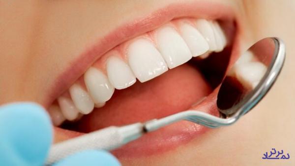 توسعه فناوری ساخت چسب دندانی در داخل کشور