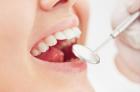 اعطای 3 استاندارد ایزو به "نانوکامپوزیتهای پرکننده دندان" محققان کشور