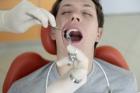 کاهش خونریزی پس از کشیدن دندان با یک مرهم پودری